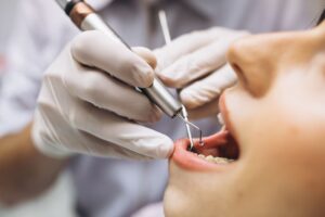 clinica dental villanueva de la cañada - limpieza dental
