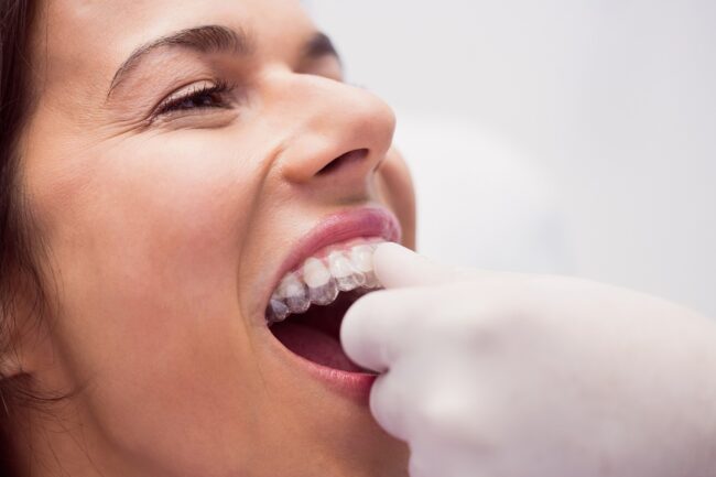 férula de descarga - sonrisa