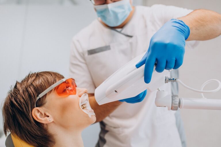 tipos de blanqueamiento dental – máquina