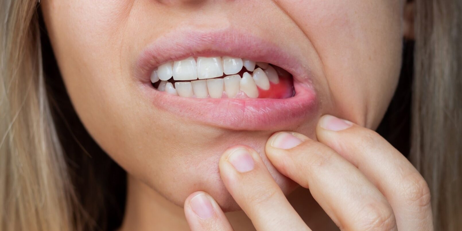 periodoncia cerca de Brunete – dolor mandibular periodoncia cerca de Brunete - dolor mandibular