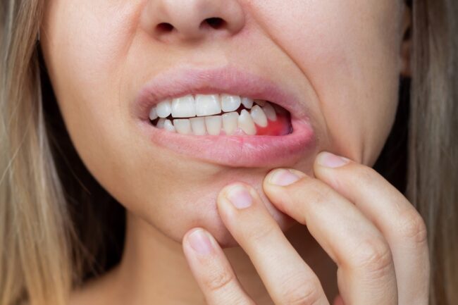 periodoncia cerca de Brunete - dolor mandibular