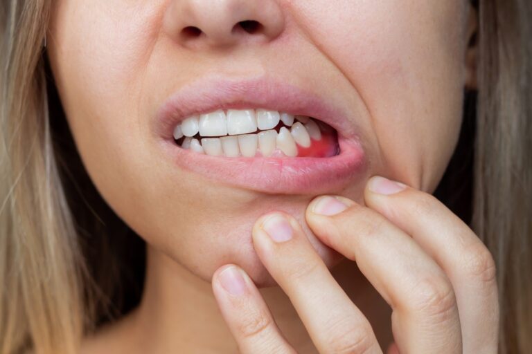 periodoncia cerca de Brunete – dolor mandibular periodoncia cerca de Brunete - dolor mandibular