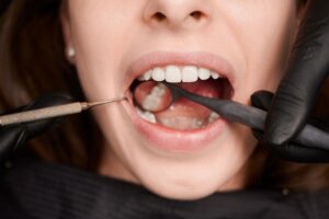 clinica dental majadahonda - revision