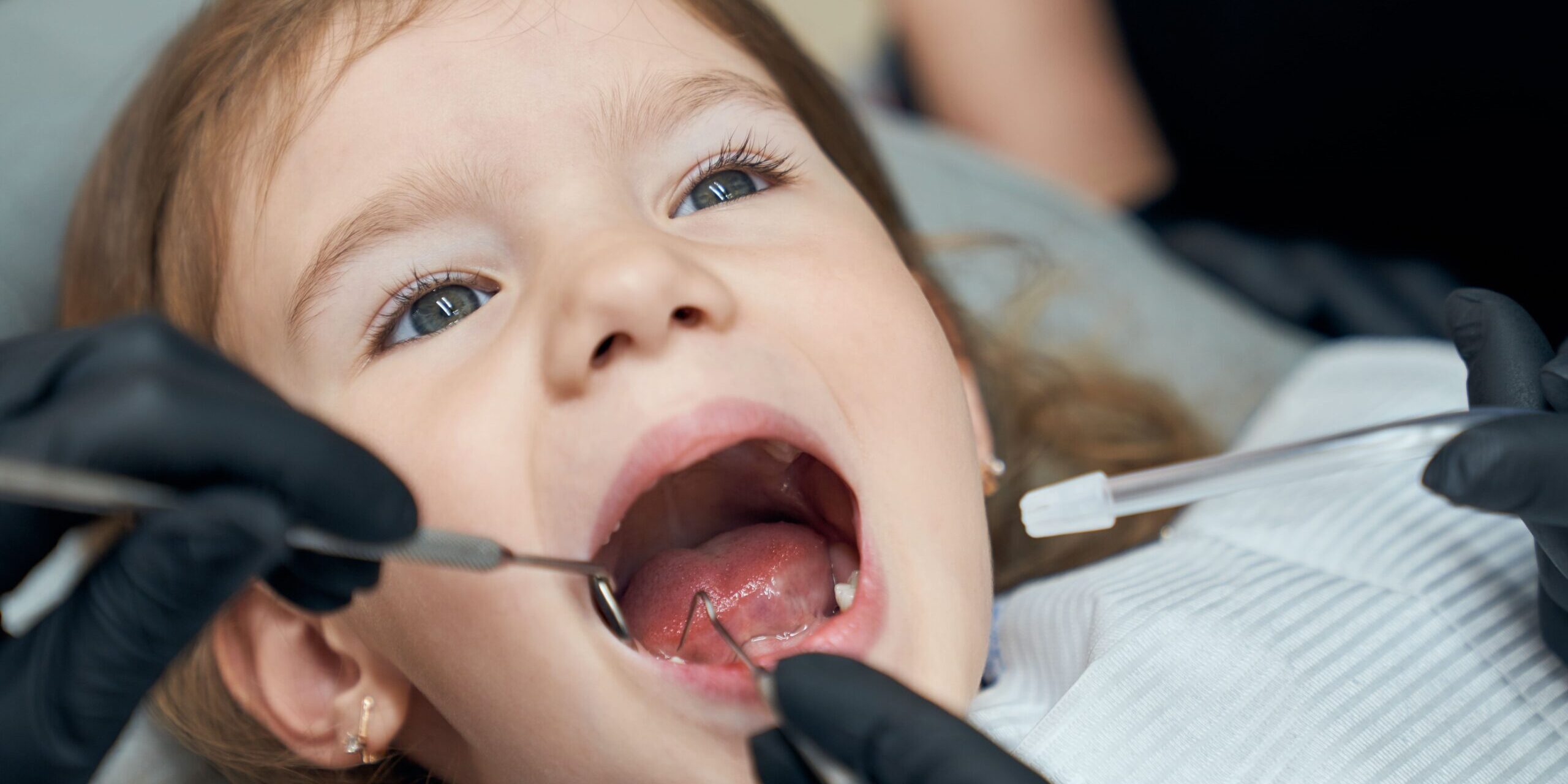 odontopediatria Majadahonda – revisión odontopediatria Majadahonda - revisión