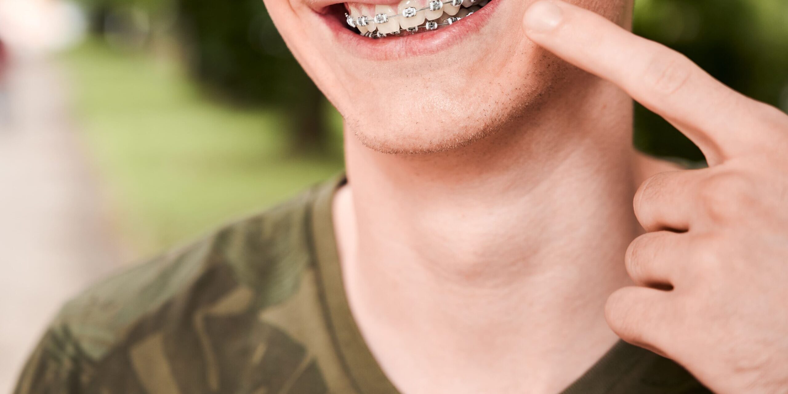 ortodoncia brunete – resultados ortodoncia brunete - resultados