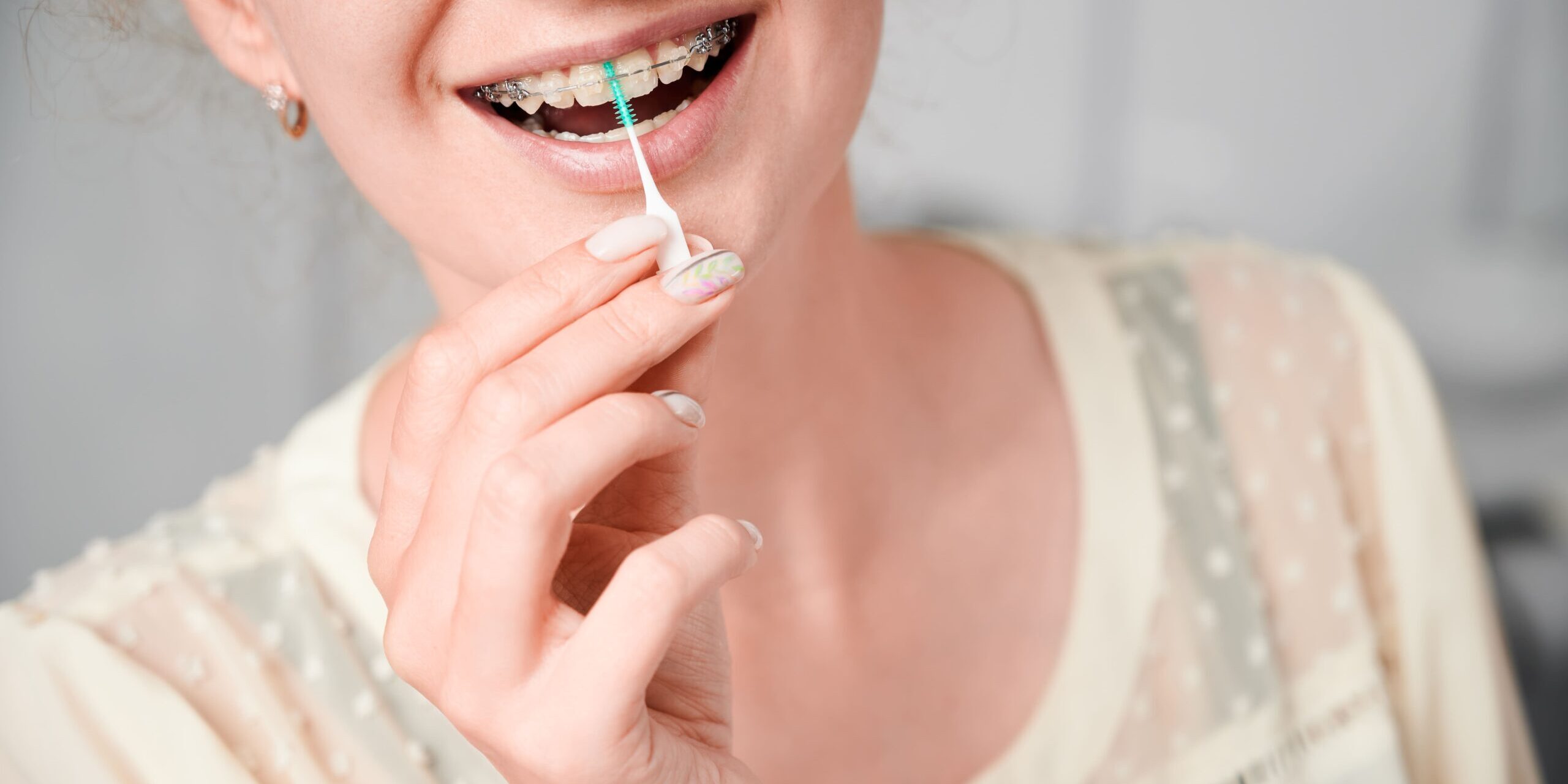 ortodoncia villanueva de la cañada - limpieza