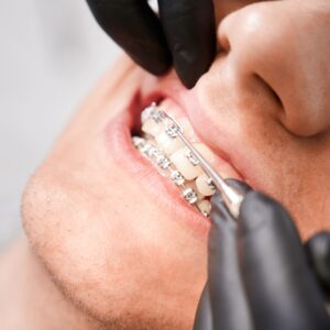 Clínica dental Brunete - ortodoncia