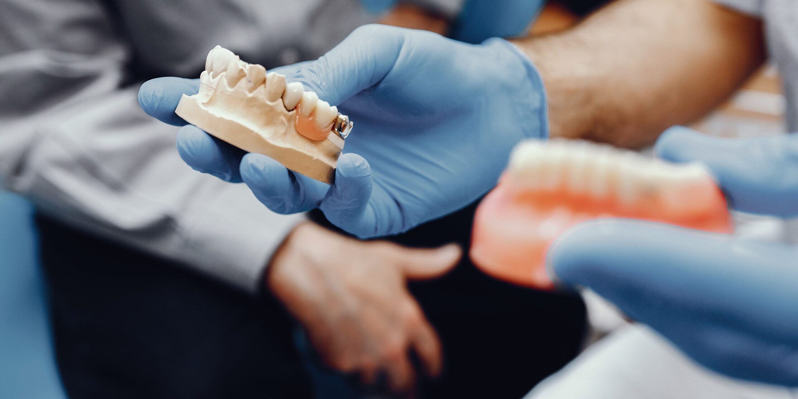 centro odontológico en Brunete - protesis mandibula