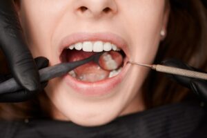 clinica dental en villanueva de la cañada - revisar dientes