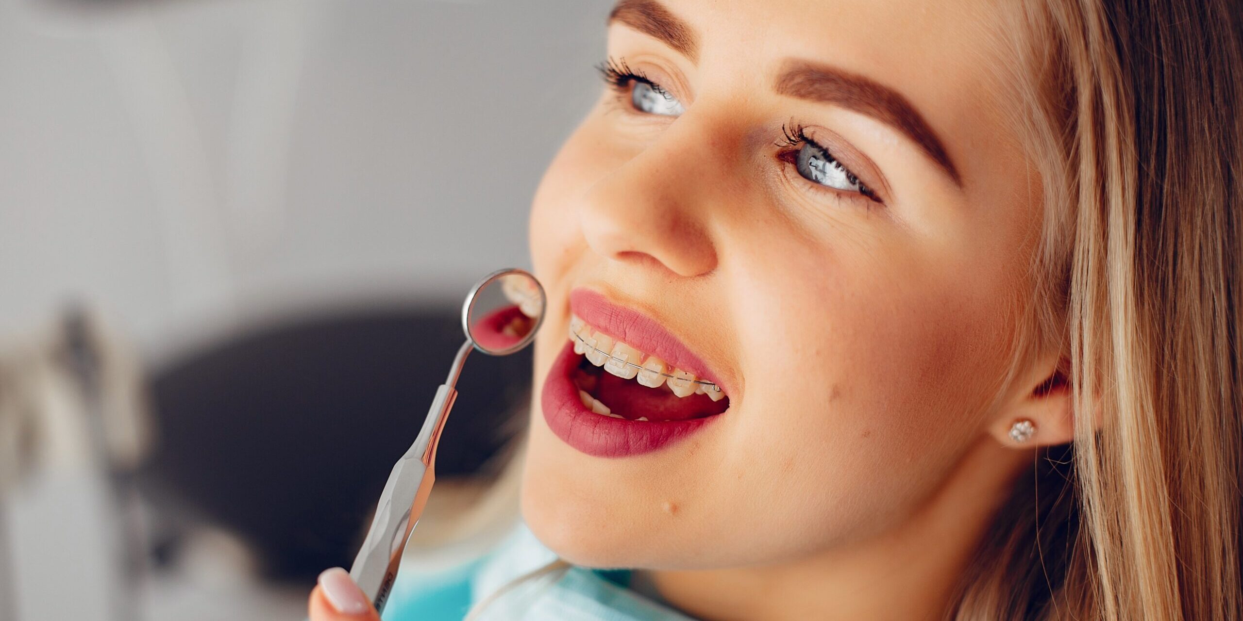 ortodoncia en Majadahonda – chica rubia revision ortodoncia en Majadahonda - chica rubia revision