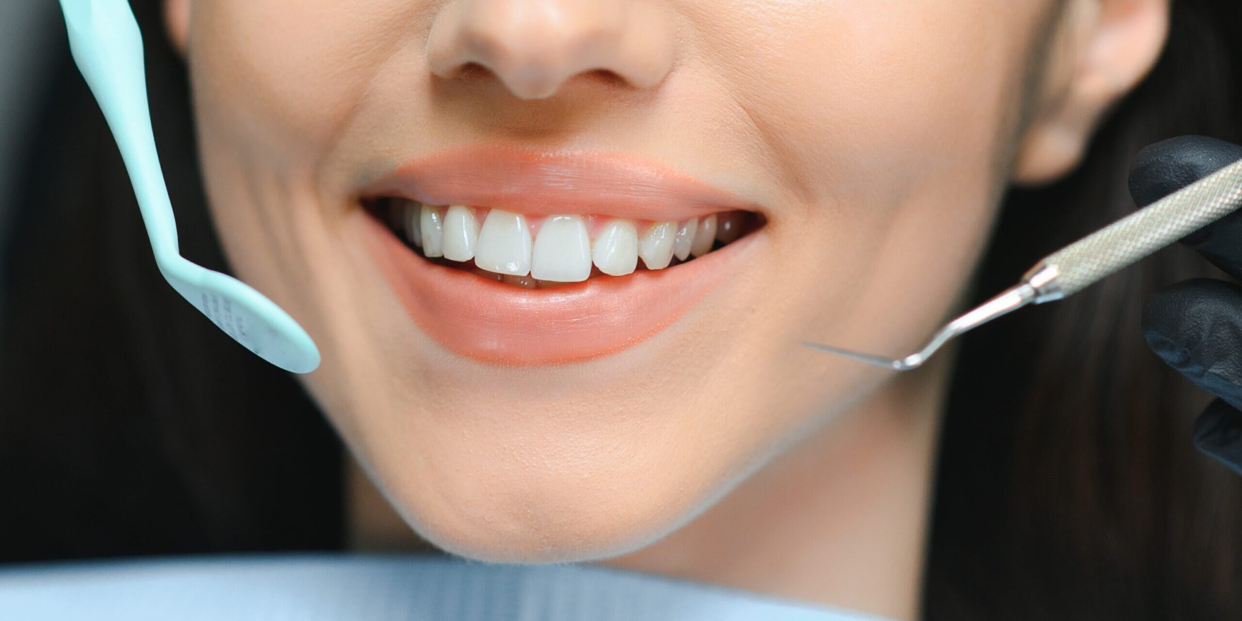 dentistas en Brunete - chica dentista sonrisa bonita