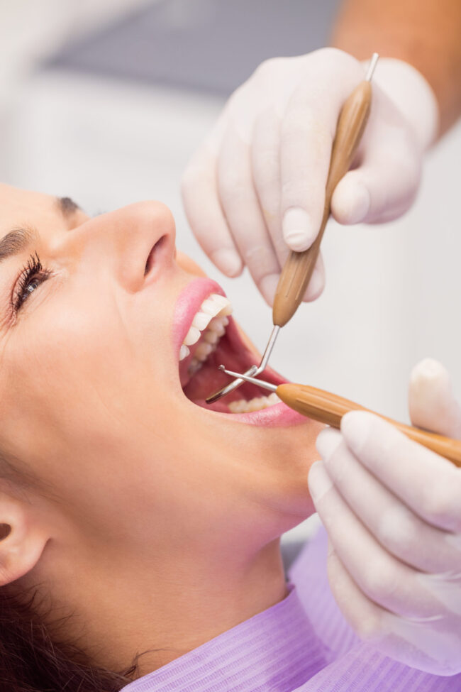 limpieza dental en villanueva de la cañada - sarro