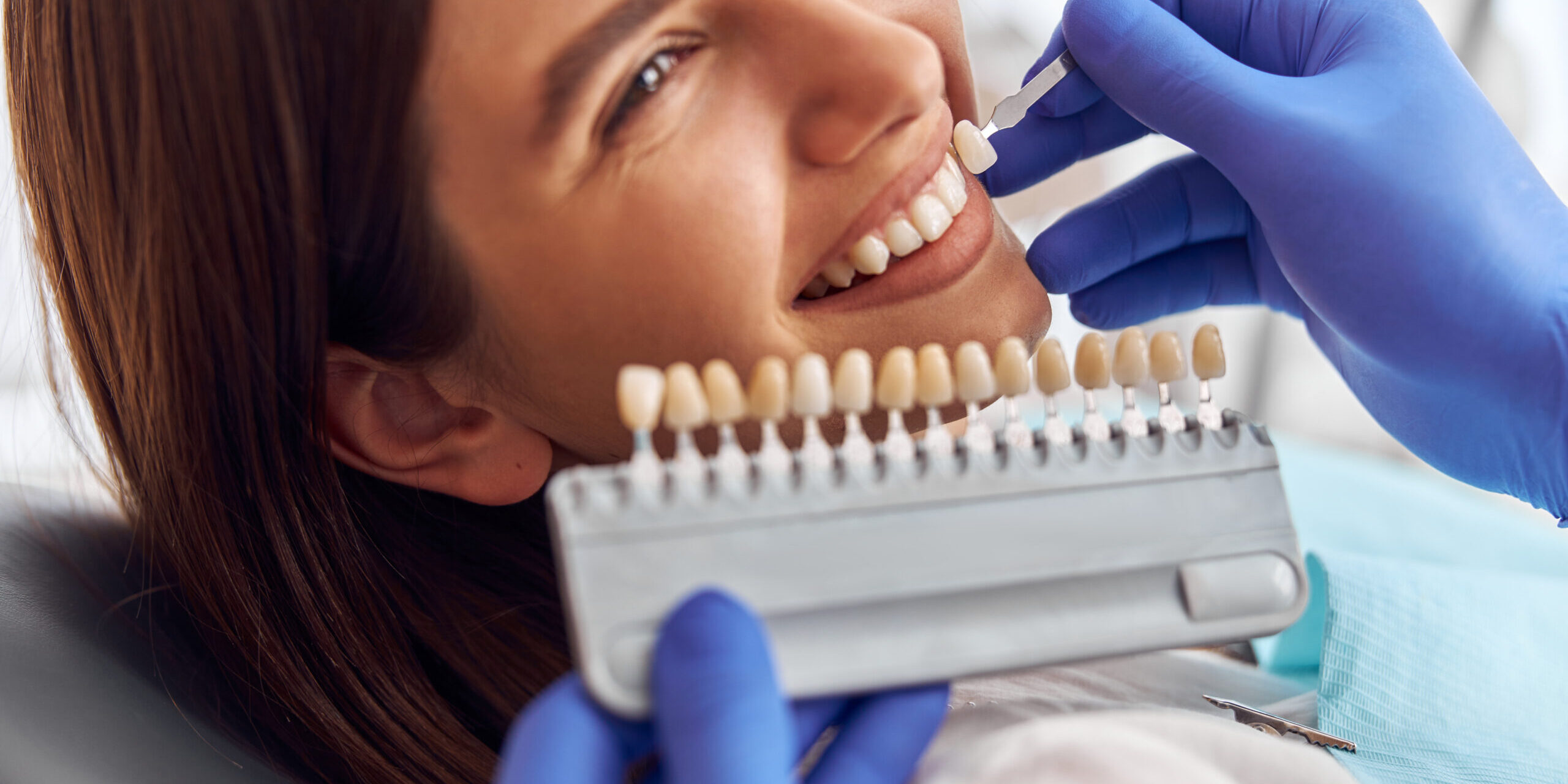 odontologia estética en majadahonda – dientes colores odontologia estética en majadahonda - dientes colores