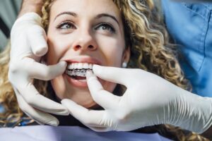 clínica like dental - ortodoncia con férulas