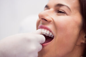 dentista-en-majadahonda-ortodoncia