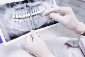 dentistas en majadahonda-rayos