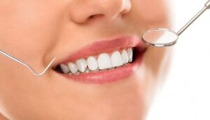 Limpieza dental en Majadahonda-dientes