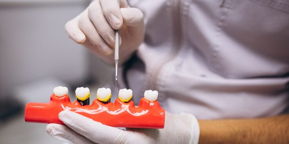 implantología y cirugía en Majadahonda-dientes implantología y cirugía en Majadahonda-dientes