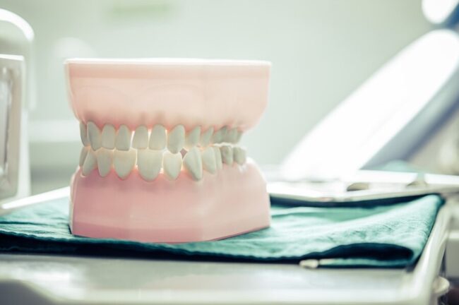 periodoncia en Brunete-dientes