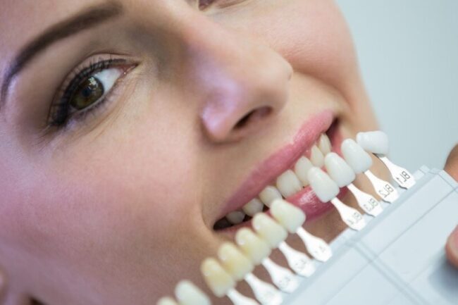 blanqueamiento en Brunete-dientes