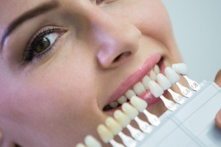 blanqueamiento en Brunete-dientes blanqueamiento en Brunete-dientes