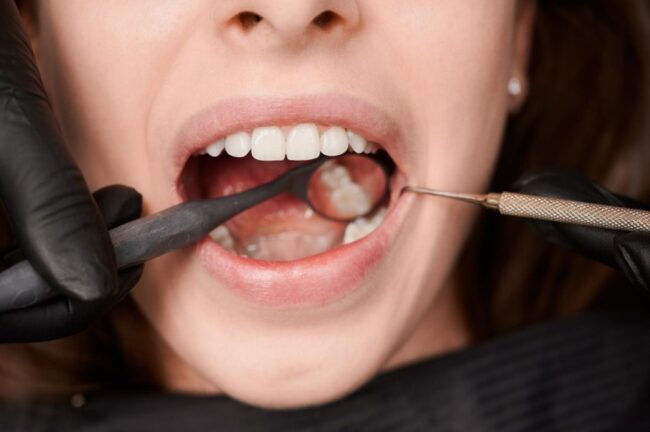 endodoncia en Villanueva de la Cañada-boca real