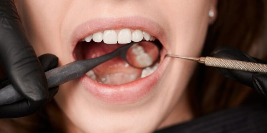 endodoncia en Villanueva de la Cañada-boca real endodoncia en Villanueva de la Cañada-boca real