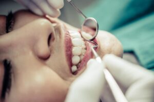 limpieza dental en Villanueva de la Cañada-dientes