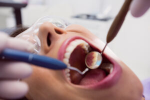 clínica dental en Villanueva de la Cañada-boca