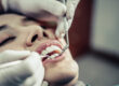 dentistas en Brunete-boca