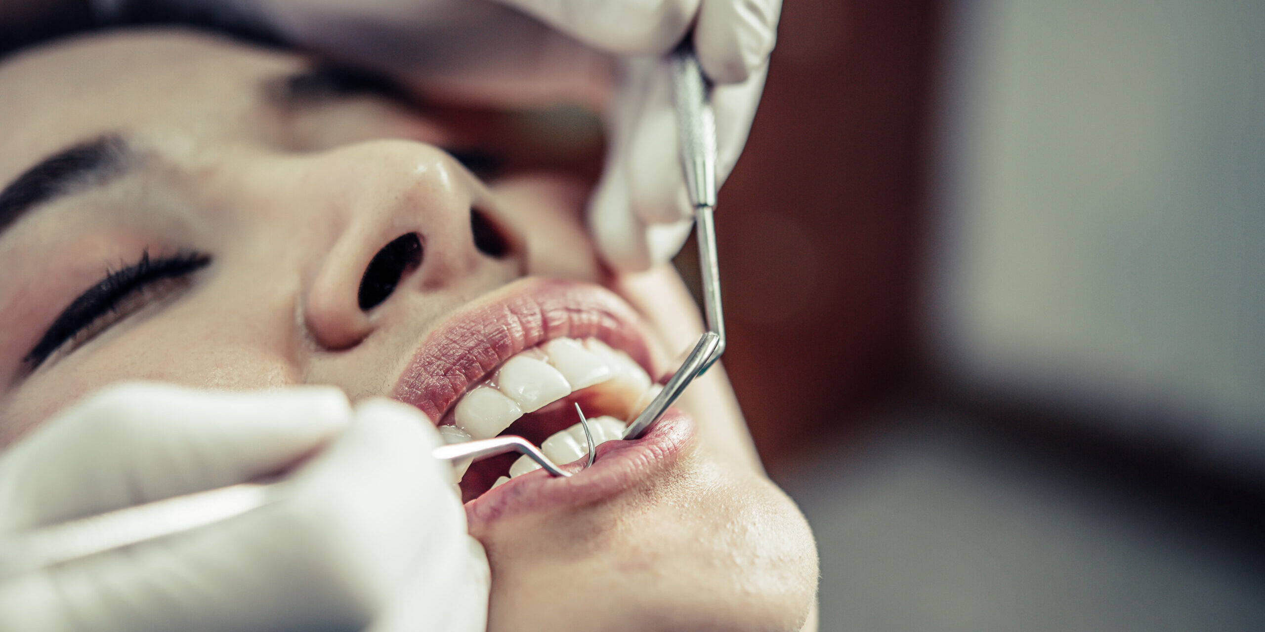 dentistas en Brunete-boca