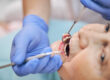 endodoncia en Majadahonda-boca