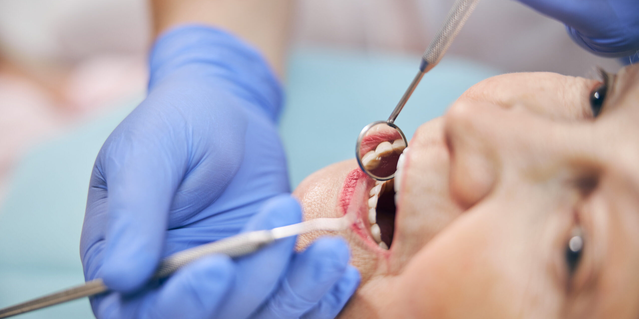 endodoncia en Majadahonda-boca