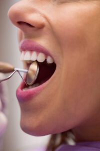 periodoncia en Brunete-boca