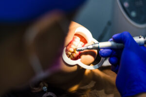 mejor dentista majadahonda - cuidado