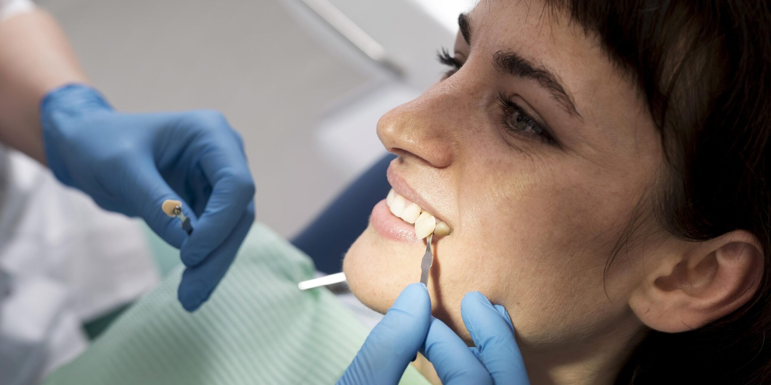 clinica dental en villanueva de la cañada - carillas