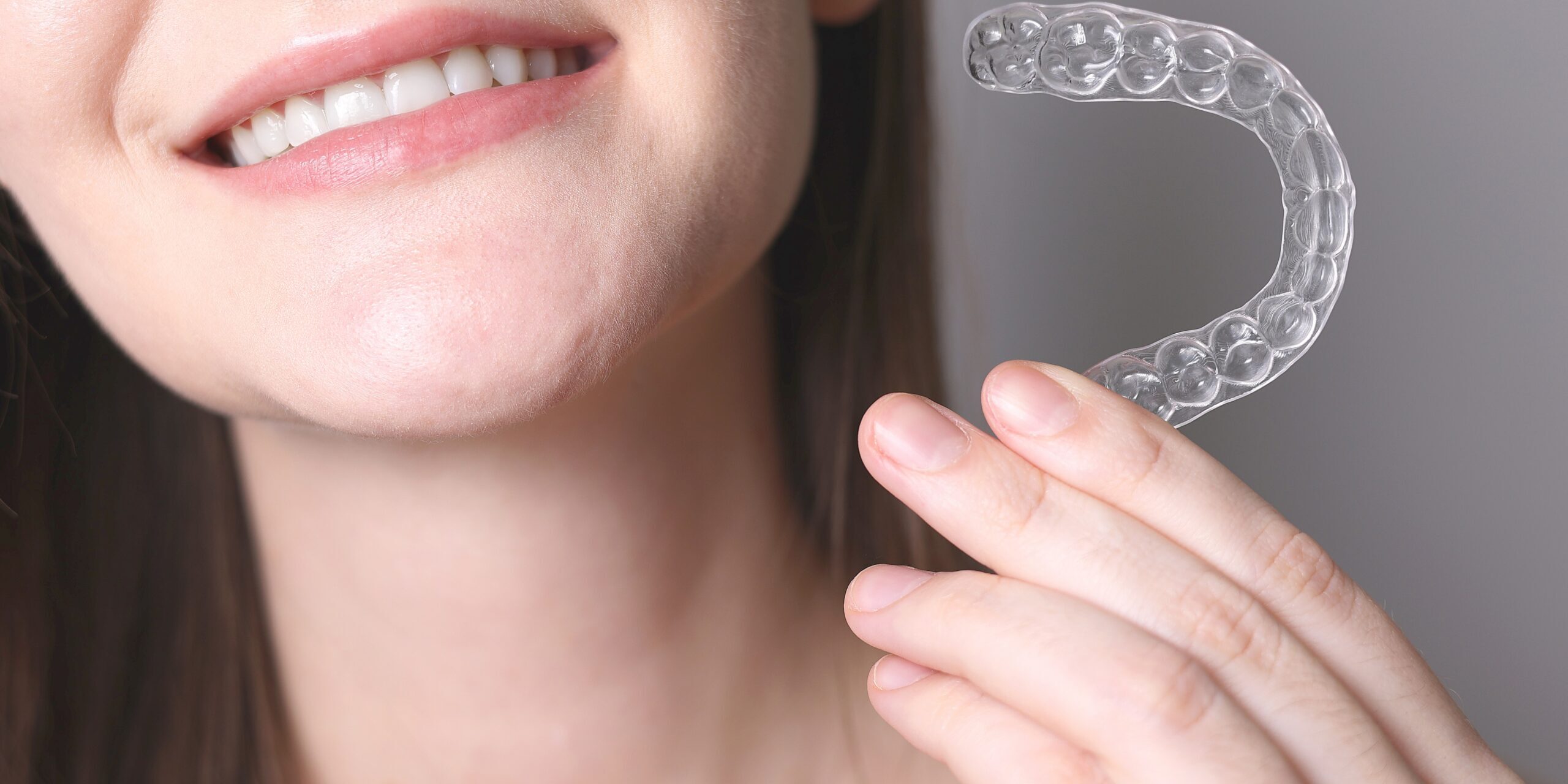 ortodoncia en Majadahonda - ortodoncia invisible